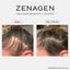 Zenagen Revolve Shampoo Treatment for Women